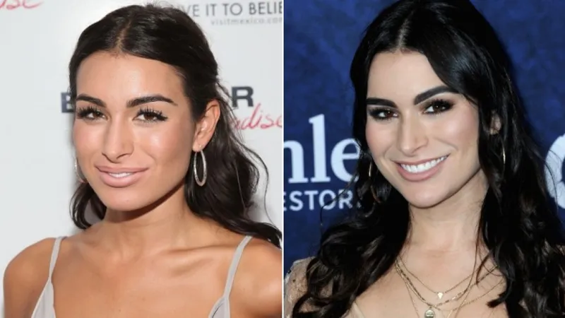 Ashley Iaconetti Cosmetic Procedures and Beauty Secrets